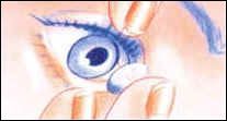 Gloeggler Optik Kontaktlinsen Pflege Umgang mit weichen Linsen 7